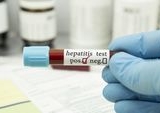 Hepatitis Pembunuh Senyap: Alasan Deteksi Dini Kritis dan Bahaya Mengintai