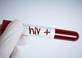 Kemenkes Klarifikasi Isu Ratusan Anak Terpapar HIV di Sidoarjo, Ungkap Data Kumulatif Nasional