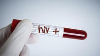 Kemenkes Klarifikasi Isu Ratusan Anak Terpapar HIV di Sidoarjo, Ungkap Data Kumulatif Nasional
