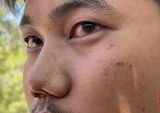 Dugaan Penganiayaan Libatkan Direskrimum Polda Sumbar Terhadap Pengendara Diselidiki Propam