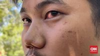Dugaan Penganiayaan Libatkan Direskrimum Polda Sumbar Terhadap Pengendara Diselidiki Propam
