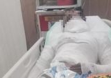 Sopir Truk di Karangasem Kritis Diduga Dibakar Bosnya, Biaya Medis Rp63 Juta Jadi Sorotan