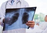 Dugaan Pes Paru Tewaskan Peneliti Rusia, Otoritas Selidiki Kepatuhan Biosekuriti Lab